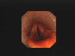 Video endoscopy 3