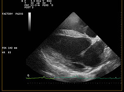 Cardiac ultrasonography