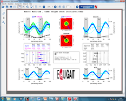 Objective Gait Analysis using EquiGait© - 1